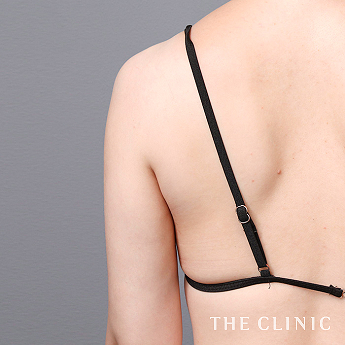 二の腕の（20代）術後症例画像