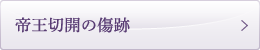 帝王切開の
傷跡